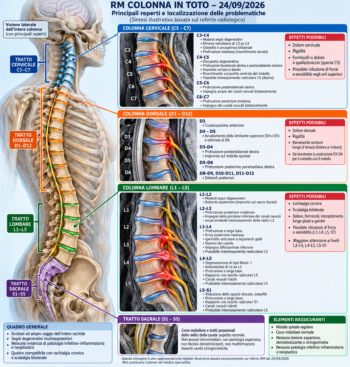 Infografica illustrativa del referto RM della colonna vertebrale di Alessandro Schiasselloni